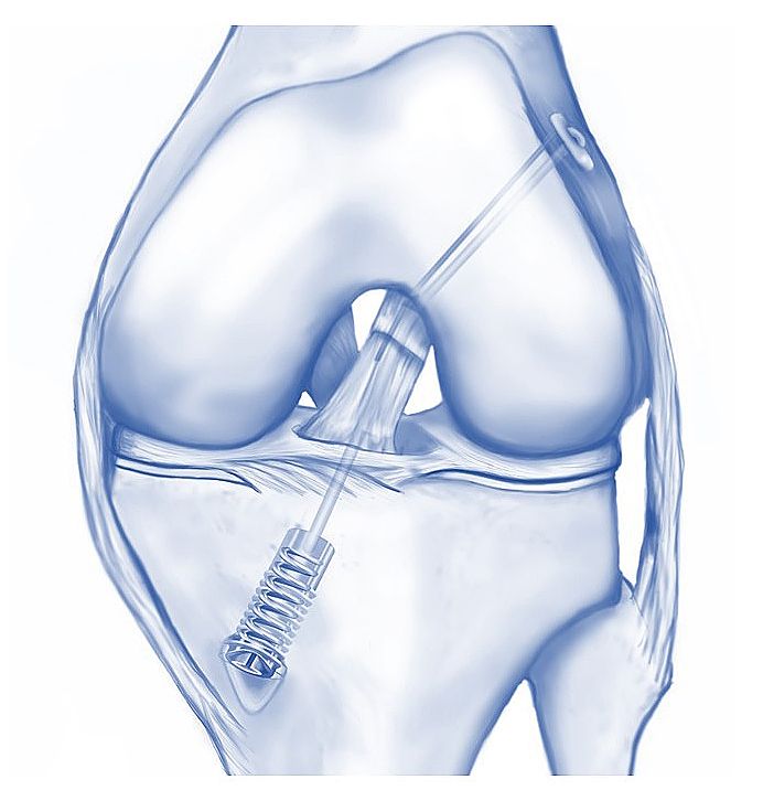 Issue 10 - Weird Tricks for Knees, Weird Risks for PGPPs, Grammar’s Effect on Pain, and Mobilization Post TKA