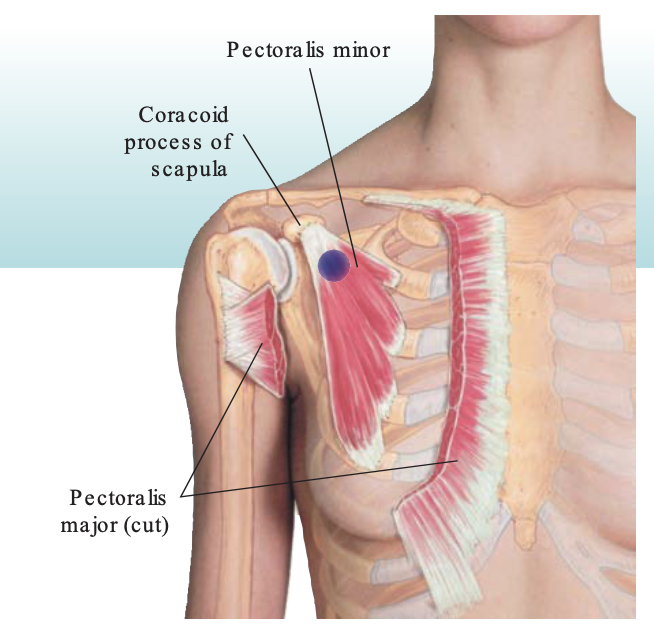 Issue 11 Blue Crab Edition - Measuring Pecs and Whether PT Can Treat Chronic Elbow Tendinopathy