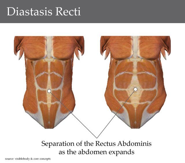 🦀 PT Crab Issue 64 - Of Pelvis and Fear.